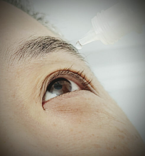 Dry Eye management